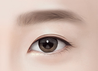 Eye surgery at Grand Plastic Surgery